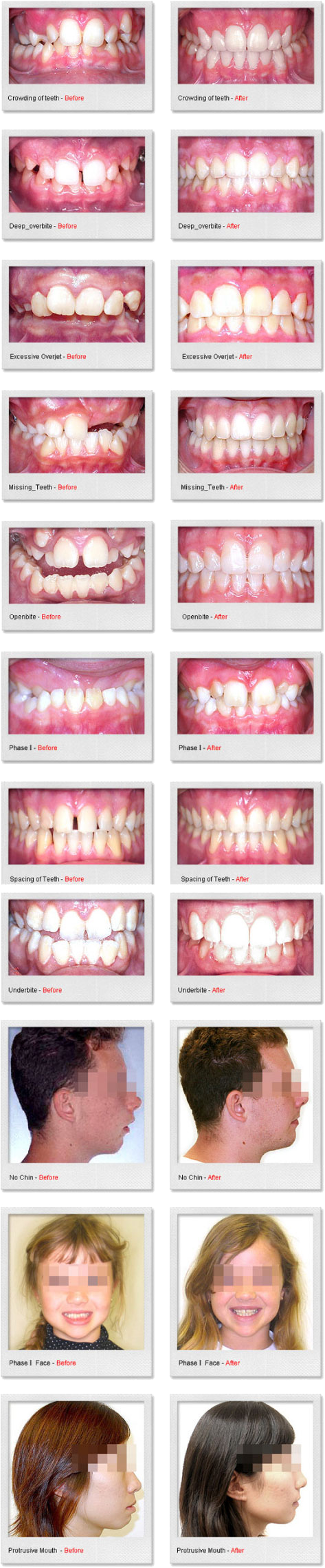 Before & After Dental Gallery